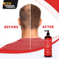 DHT Blocker Anti Hair Loss Shampoo and Conditioner set with Biotin (2 x 16 Oz)