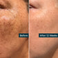 Retinol Plus Vitamin C Skin Refining Night Oil