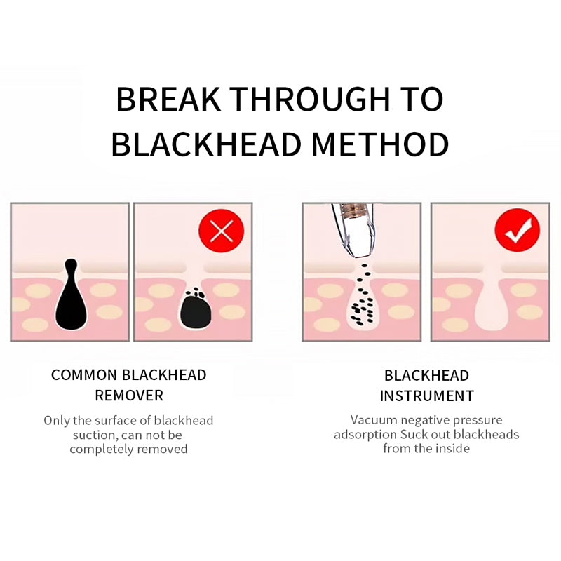 Blackhead Remover Vacuum Deep Pore Cleaner Facial Spa Tool
