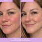 THE PLACENTA FACIAL Dark Spot Serum + Barrier Repair Cream Bundle